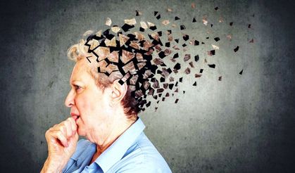 Milyonlarca sağlıklı insana Alzheimer tanımı konabilir